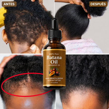 BellaHair Growth Oil Batana